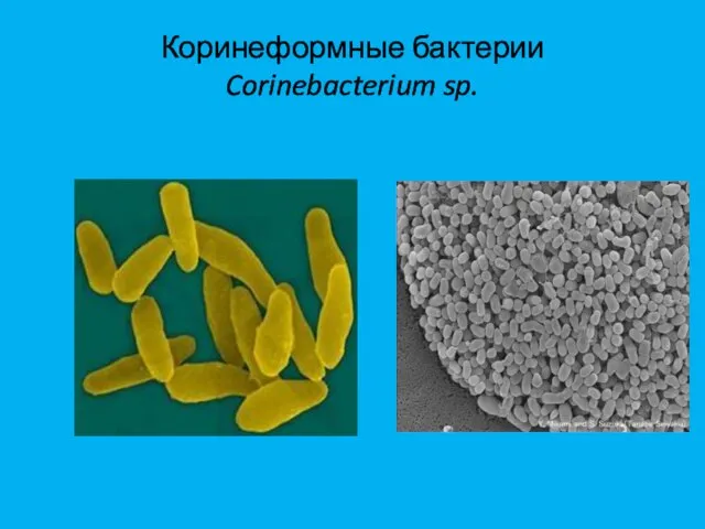 Коринеформные бактерии Corinebacterium sp.