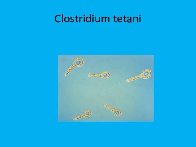 Clostridium tetani