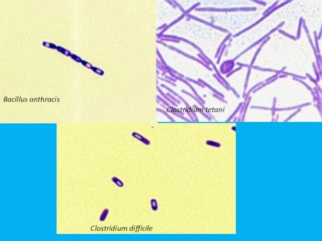 Clostridium tetani Clostridium difficile Bacillus anthracis