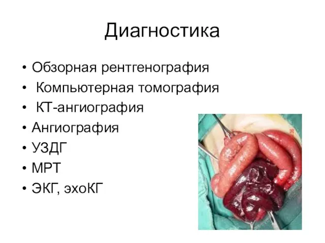 Диагностика Обзорная рентгенография Компьютерная томография КТ-ангиография Ангиография УЗДГ МРТ ЭКГ, эхоКГ