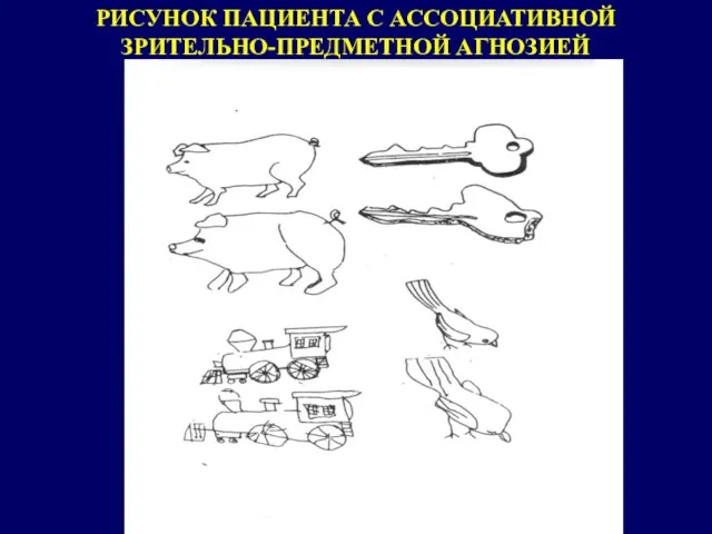 РИСУНОК ПАЦИЕНТА С АССОЦИАТИВНОЙ ЗРИТЕЛЬНО-ПРЕДМЕТНОЙ АГНОЗИЕЙ