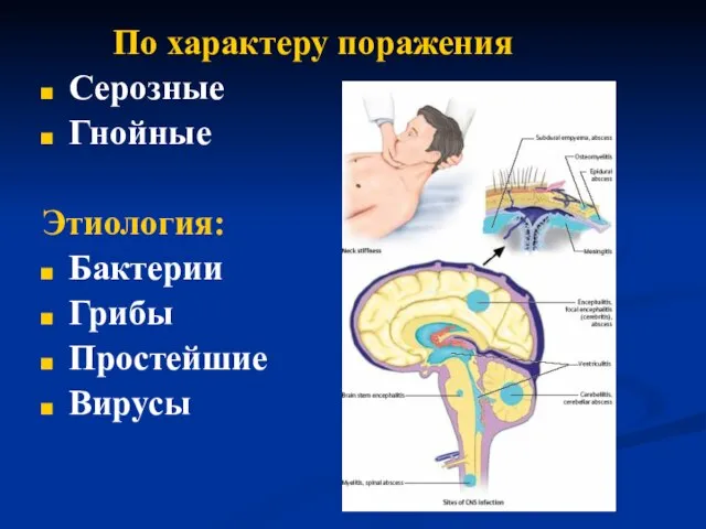 По характеру поражения Серозные Гнойные Этиология: Бактерии Грибы Простейшие Вирусы