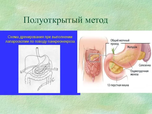 Полуоткрытый метод