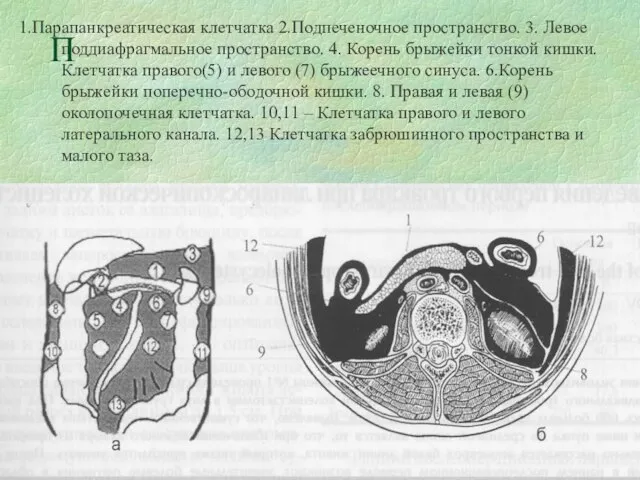 1.Парапанкреатическая клетчатка 2.Подпеченочное пространство. 3. Левое поддиафрагмальное пространство. 4. Корень брыжейки