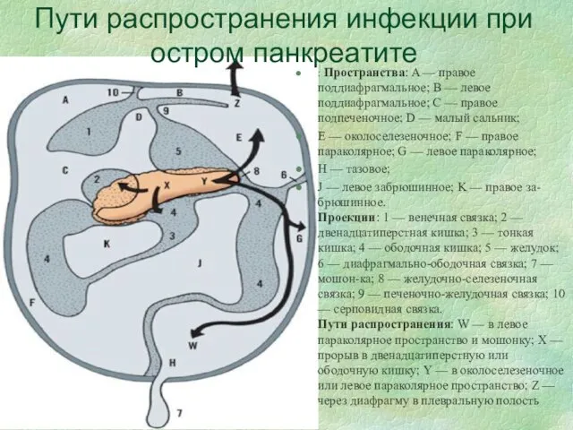 Пути распространения инфекции при остром панкреатите : Пространства: A — правое