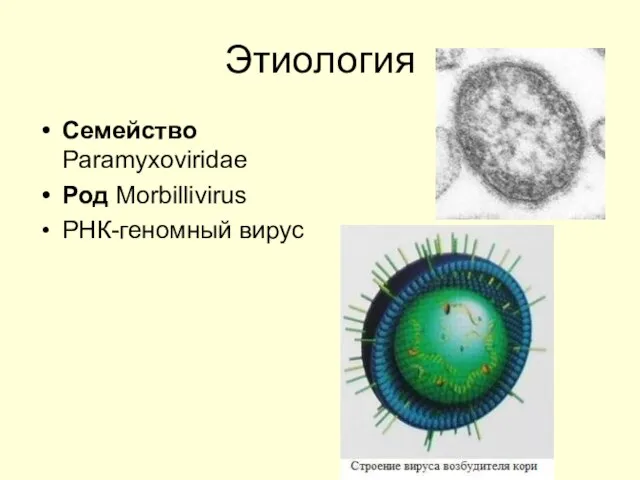 Этиология Семейство Paramyxoviridae Род Morbillivirus РНК-геномный вирус