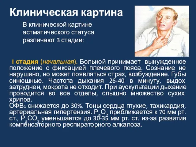 Клиническая картина I стадия (начальная). Больной принимает вынужденное положение с фиксацией