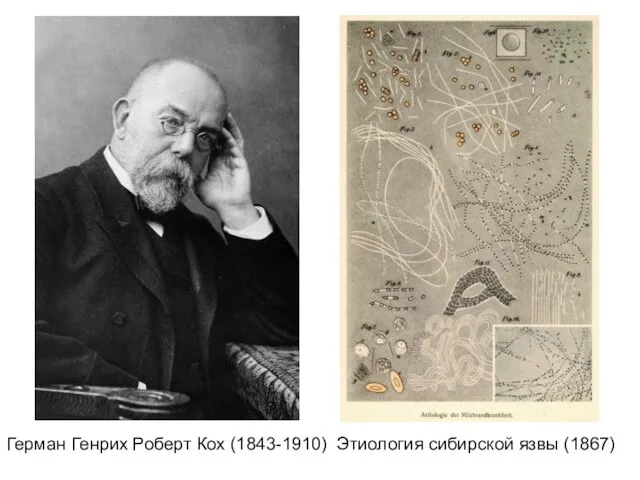 Герман Генрих Роберт Кох (1843-1910) Этиология сибирской язвы (1867)