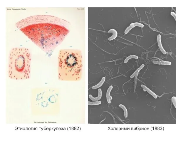 Этиология туберкулеза (1882) Холерный вибрион (1883)