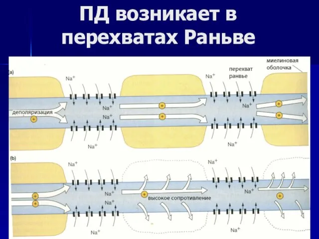 ПД возникает в перехватах Раньве