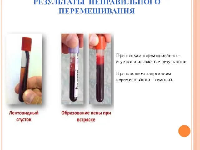 РЕЗУЛЬТАТЫ НЕПРАВИЛЬНОГО ПЕРЕМЕШИВАНИЯ При плохом перемешивании – сгустки и искажение результатов.