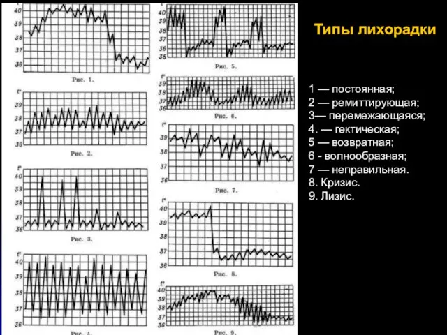 Типы лихорадки 1 — постоянная; 2 — ремиттирующая; 3— перемежающаяся; 4.