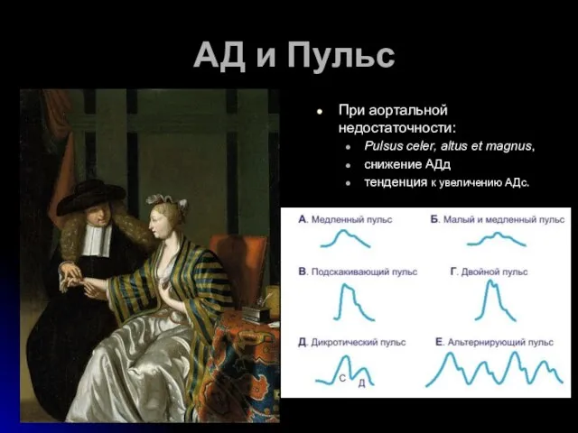 АД и Пульс При аортальной недостаточности: Рulsus celer, altus et magnus,