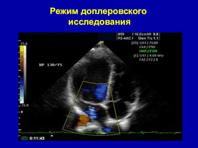 Режим доплеровского исследования