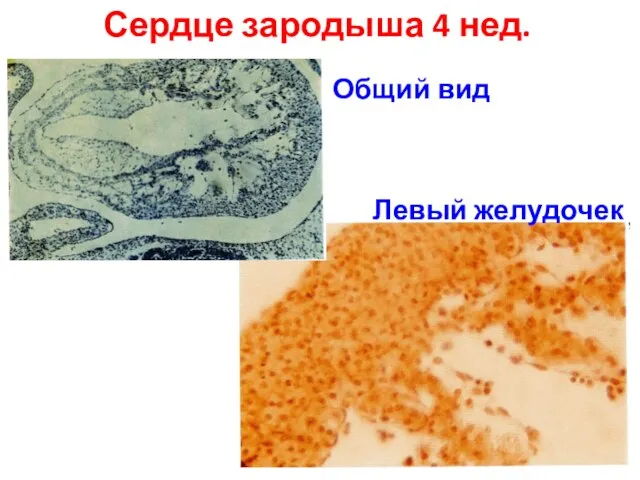 Сердце зародыша 4 нед. Общий вид Левый желудочек