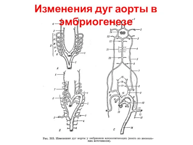 Изменения дуг аорты в эмбриогенезе