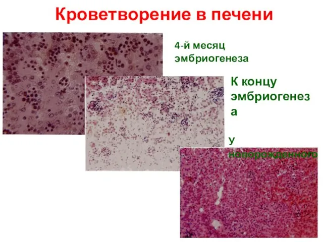 Кроветворение в печени 4-й месяц эмбриогенеза К концу эмбриогенеза У новорожденного