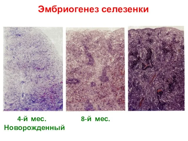 Эмбриогенез селезенки 4-й мес. 8-й мес. Новорожденный