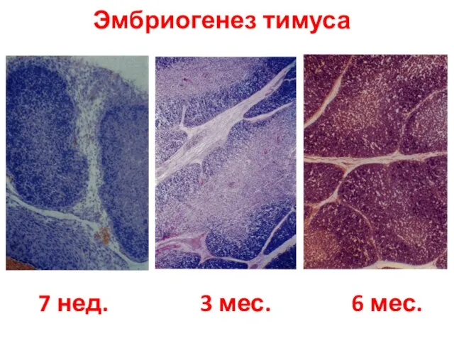 Эмбриогенез тимуса 7 нед. 3 мес. 6 мес.