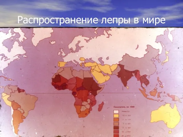 Распространение лепры в мире