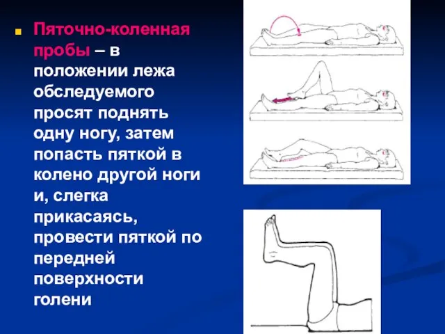 Пяточно-коленная пробы – в положении лежа обследуемого просят поднять одну ногу,