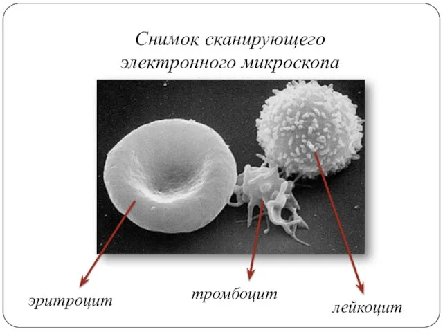 Снимок сканирующего электронного микроскопа эритроцит тромбоцит лейкоцит