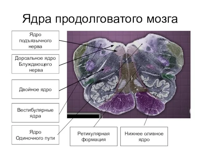 Ядра продолговатого мозга Ядро подъязычного нерва Дорсальное ядро Блуждающего нерва Двойное