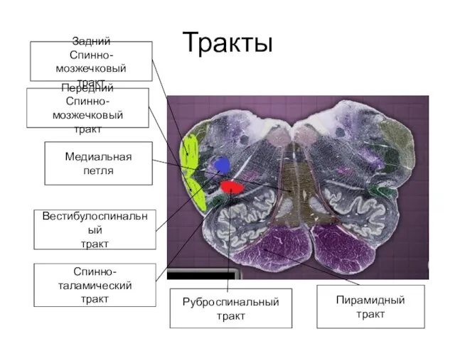 Тракты Пирамидный тракт Медиальная петля Спинно-таламический тракт Передний Спинно-мозжечковый тракт Задний