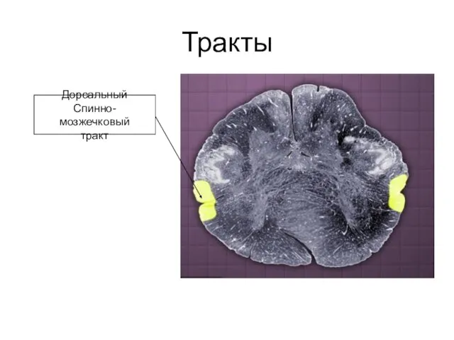 Тракты Дорсальный Спинно-мозжечковый тракт