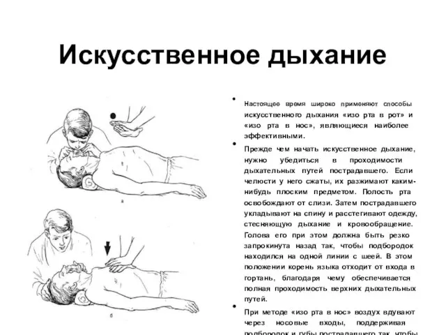 Искусственное дыхание Настоящее время широко применяют способы искусственного дыхания «изо рта