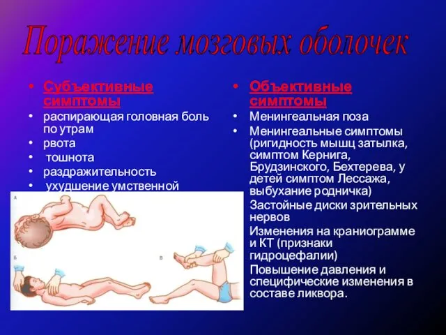 Субъективные симптомы распирающая головная боль по утрам рвота тошнота раздражительность ухудшение