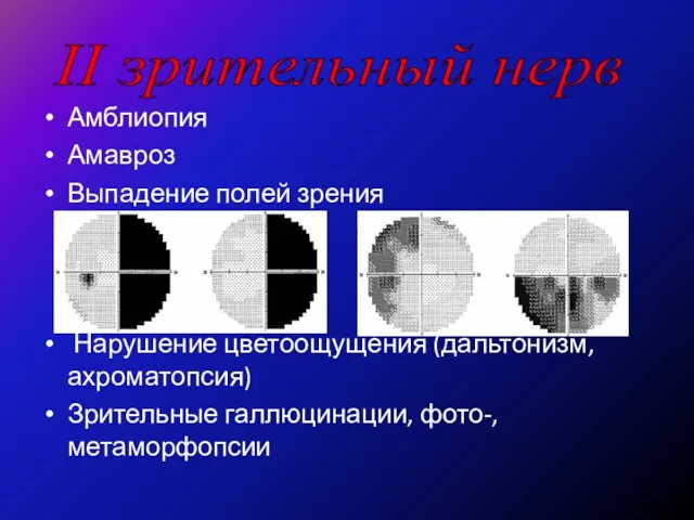 Амблиопия Амавроз Выпадение полей зрения Нарушение цветоощущения (дальтонизм, ахроматопсия) Зрительные галлюцинации, фото-, метаморфопсии II зрительный нерв