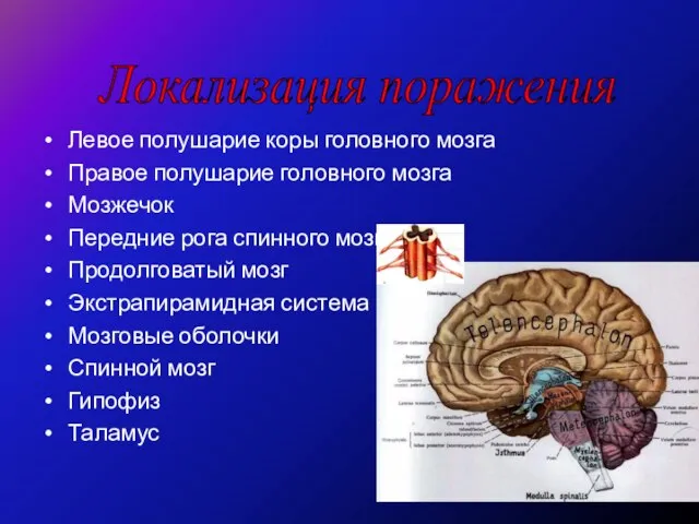 Левое полушарие коры головного мозга Правое полушарие головного мозга Мозжечок Передние