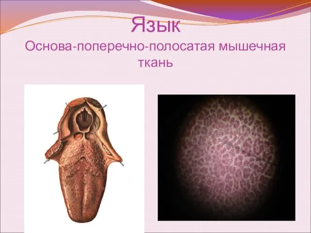 Язык Основа-поперечно-полосатая мышечная ткань