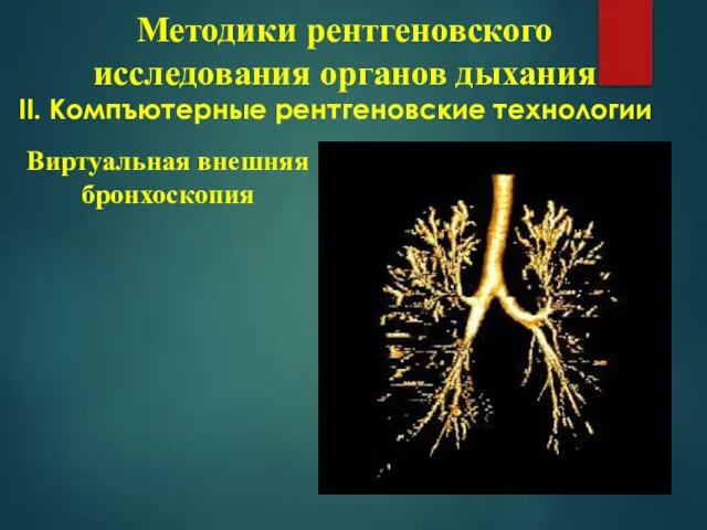 ІІ. Компъютерные рентгеновские технологии Методики рентгеновского исследования органов дыхания Виртуальная внешняя бронхоскопия