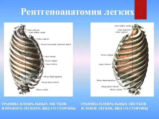 Рентгеноанатомия легких ГРАНИЦА ПЛЕВРАЛЬНЫХ ЛИСТКОВ И ПРАВОГО ЛЕГКОГО, ВИД СО СТОРОНЫ