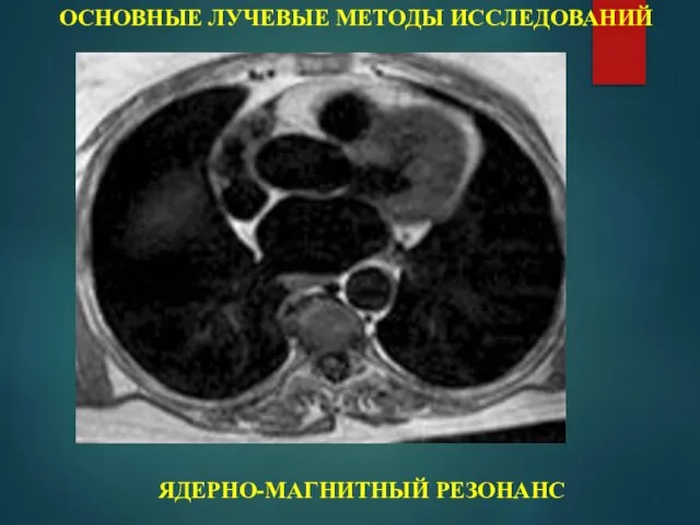 ОСНОВНЫЕ ЛУЧЕВЫЕ МЕТОДЫ ИССЛЕДОВАНИЙ ЯДЕРНО-МАГНИТНЫЙ РЕЗОНАНС