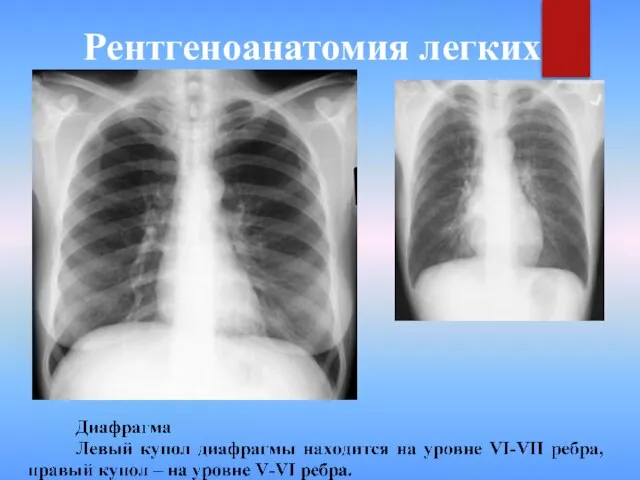 Рентгеноанатомия легких