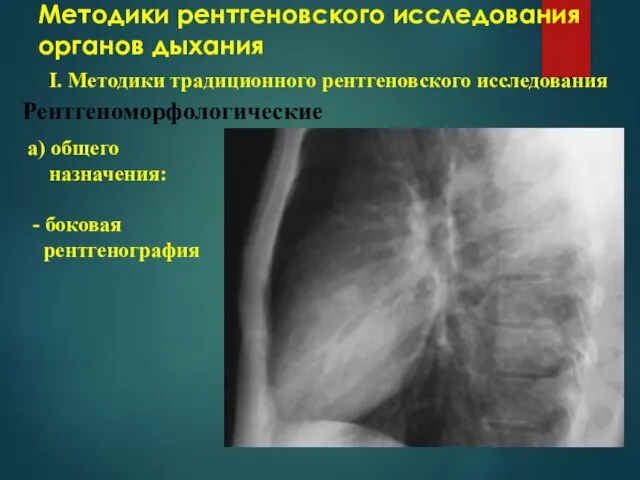 Методики рентгеновского исследования органов дыхания