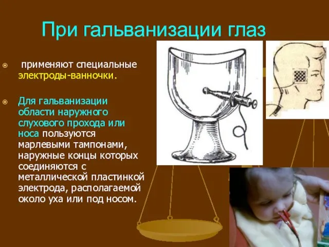 При гальванизации глаз применяют специальные электроды-ванночки. Для гальванизации области наружного слухового