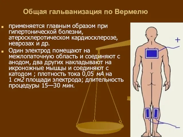 Общая гальванизация по Вермелю применяется главным образом при гипертонической болезни, атеросклеротическом