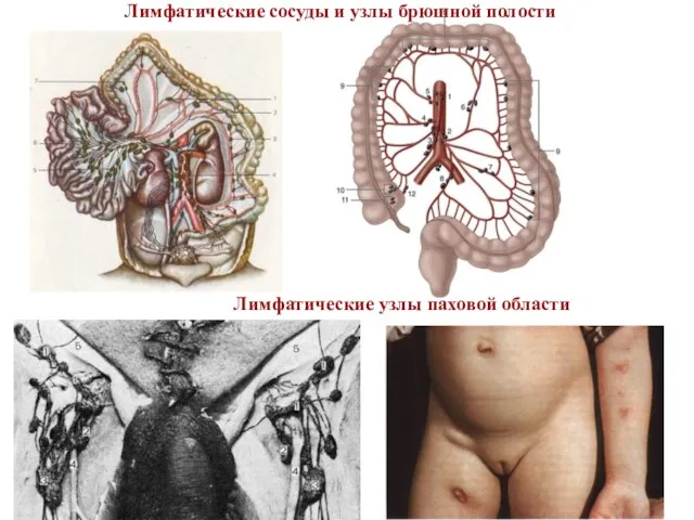 Лимфатические сосуды и узлы брюшной полости Лимфатические узлы паховой области