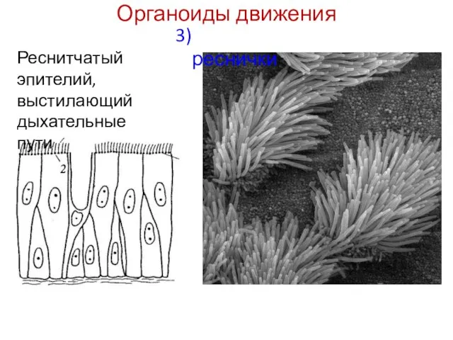 Органоиды движения 3) реснички Реснитчатый эпителий, выстилающий дыхательные пути