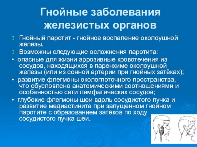 Гнойные заболевания железистых органов Гнойный паротит - гнойное воспаление околоушной железы.