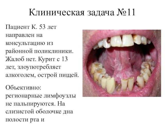 Клиническая задача №11 Пациент К. 53 лет направлен на консультацию из