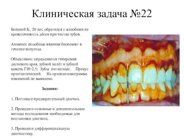 Клиническая задача №22 Больной Б., 20 лет, обратился с жалобами на