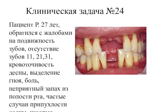 Клиническая задача №24 Пациент Р. 27 лет, обратился с жалобами на