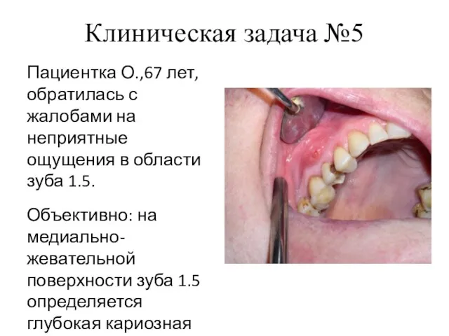 Клиническая задача №5 Пациентка О.,67 лет, обратилась с жалобами на неприятные