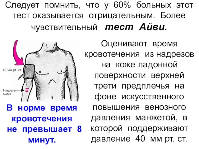 Следует помнить, что у 60% больных этот тест оказывается отрицательным. Более