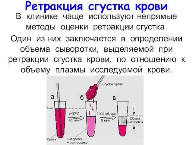 Ретракция сгустка крови В клинике чаще используют непрямые методы оценки ретракции